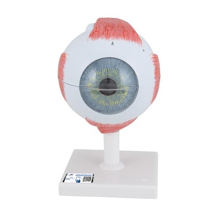 Eye, 5 Times Full-size, 6 Part - W/ 3B Smart Anatomy